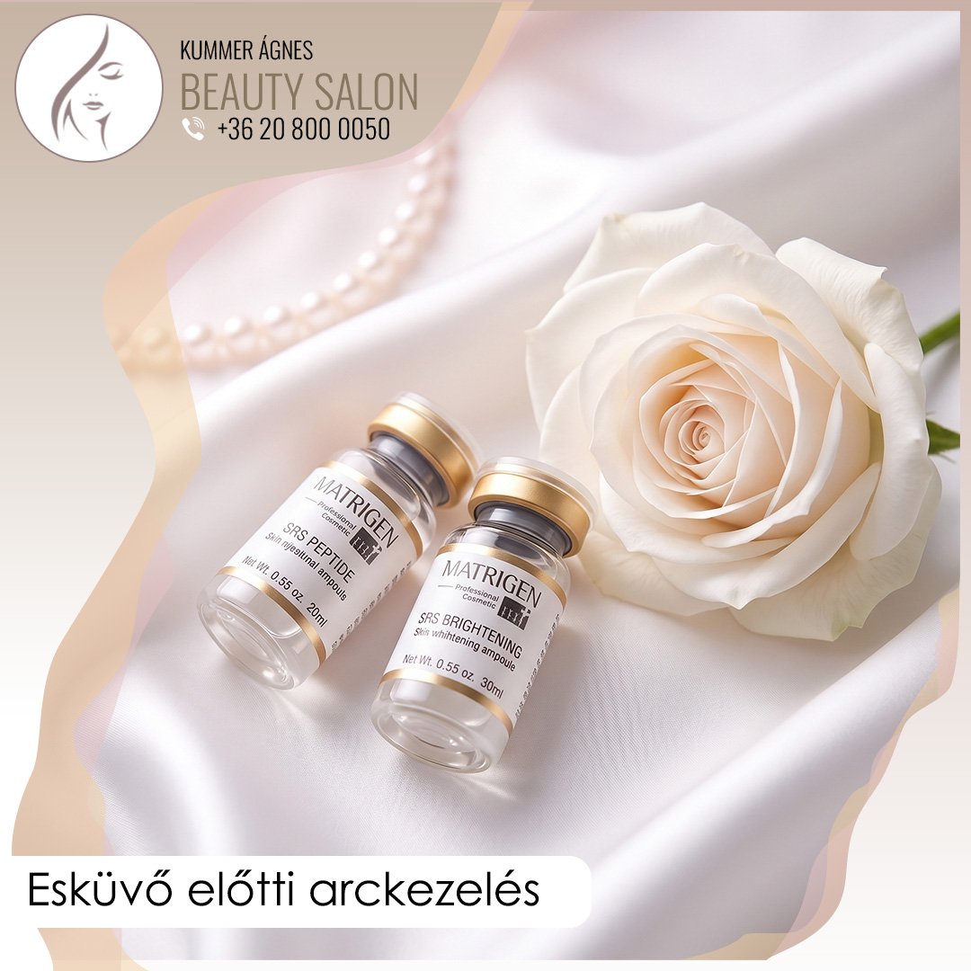 esküvő előtti arckezelés
